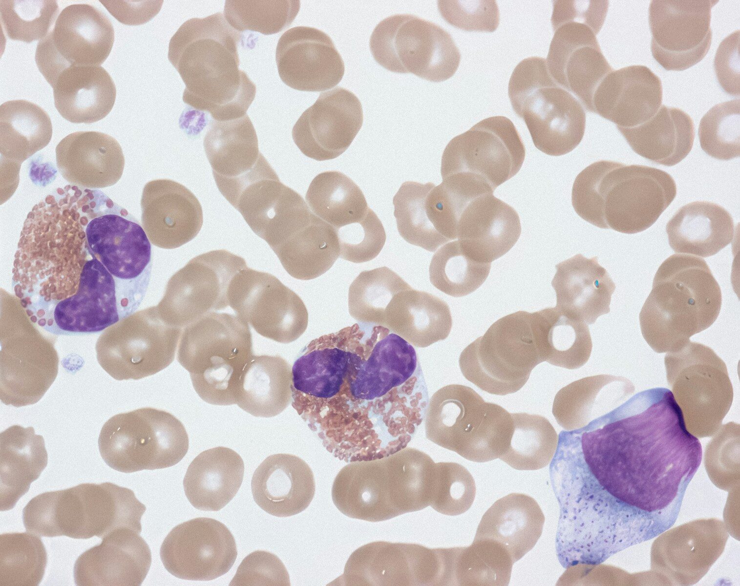 infection and Sperm Quality