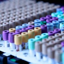 testing and diagnosis for male fertility