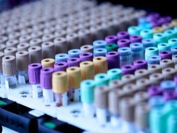 testing and diagnosis for male fertility