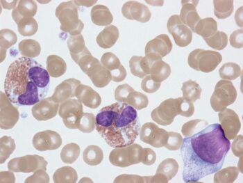 infection and Sperm Quality